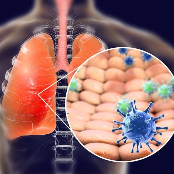 Coronavirus