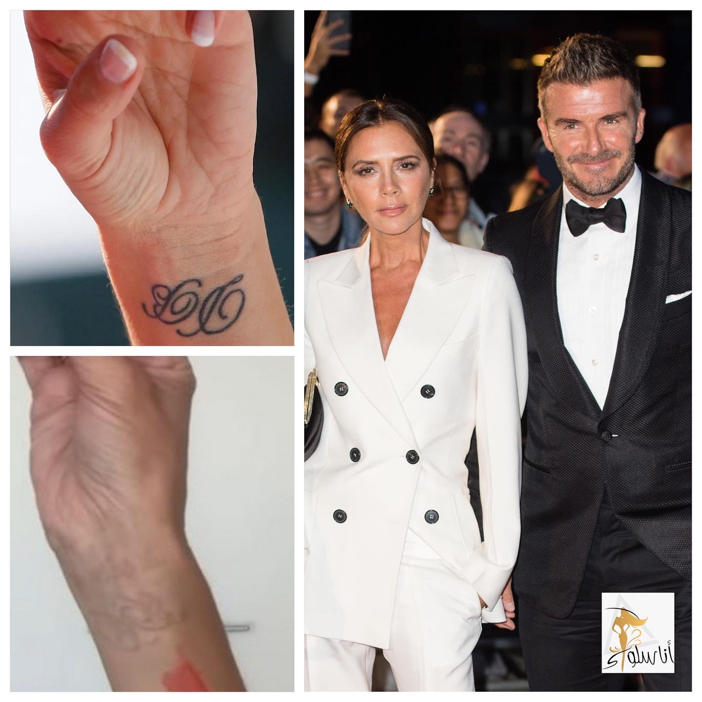 Victoria Beckham hoqi tatuazhin e emrit të David Beckham