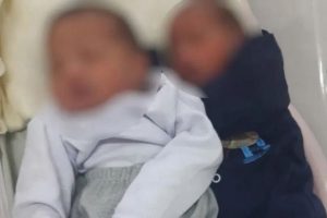 Brazilė su skirtingais tėvais pagimdo dvynukus