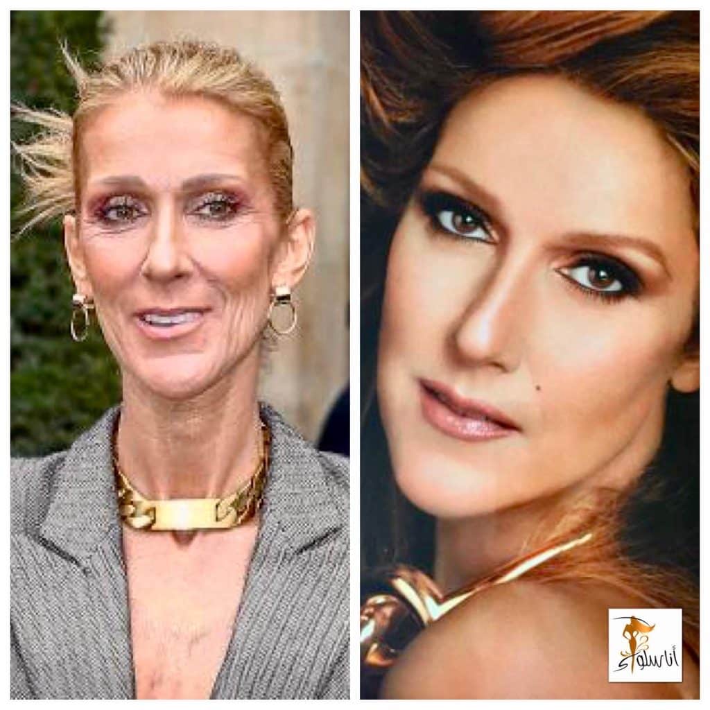 UCeline Dion